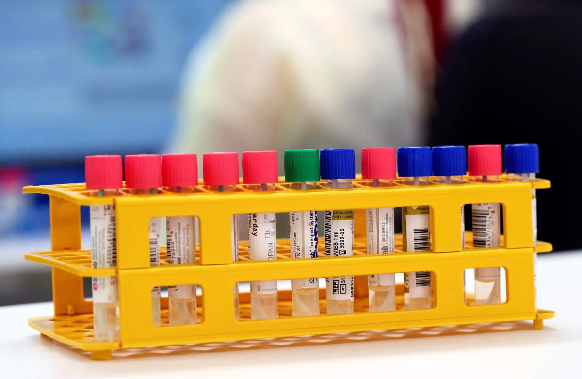 Tube tests on display at the Microbiology Laboratory of the University Hospital (CHUV) during the outbreak of the SARS-CoV-2 coronavirus causing the COVID-19 disease in Lausanne, Switzerland, March 23, 2020.