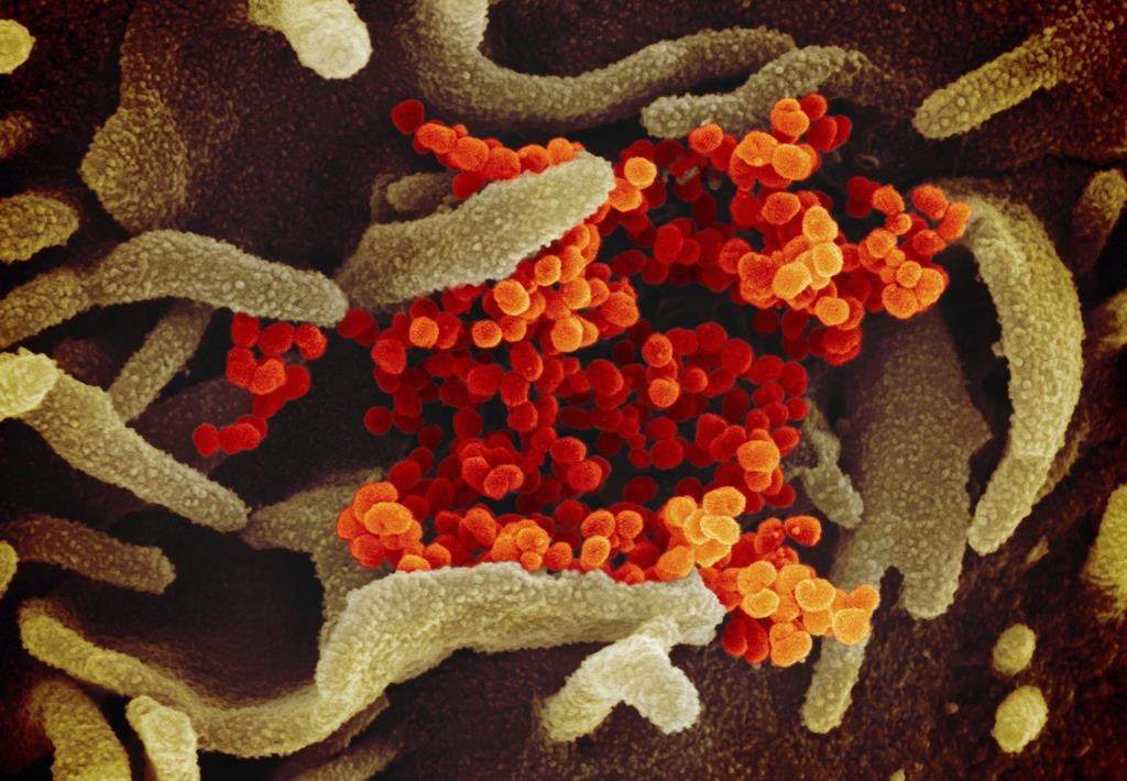 This undated electron microscope image made available by the U.S. National Institutes of Health in February 2020 shows the novel coronavirus SARS-CoV-2, orange, emerging from the surface of cells, green, cultured in the lab.