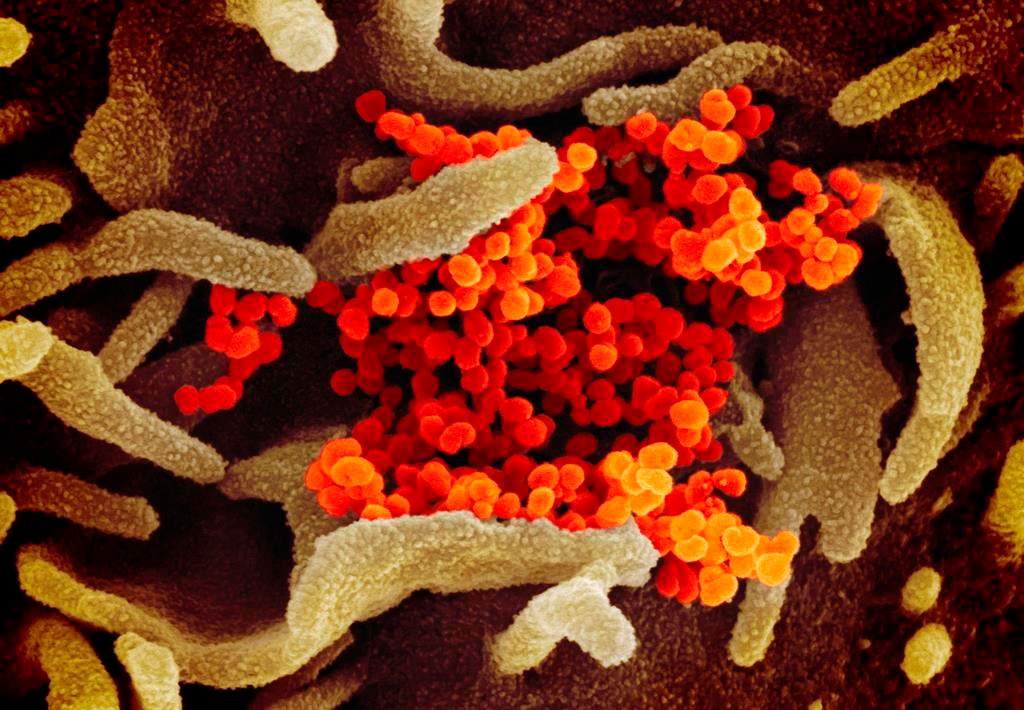 This undated electron microscope image made available by the U.S. National Institutes of Health in February 2020 shows the Novel Coronavirus SARS-CoV-2, orange, emerging from the surface of cells, green, cultured in the lab. 