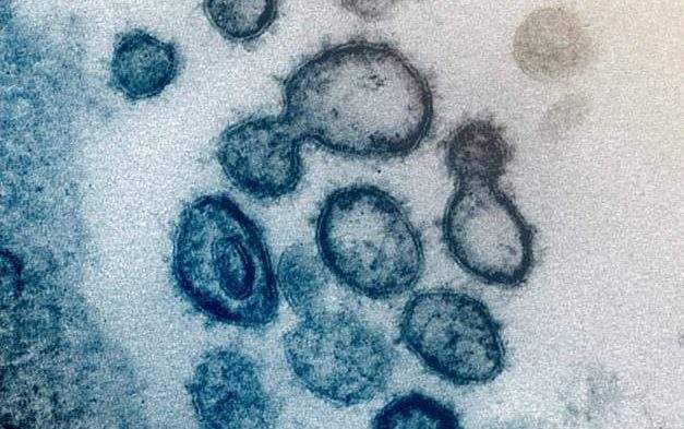 Manitoba reported 402 new COVID-19 cases and four additional deaths Wednesday.