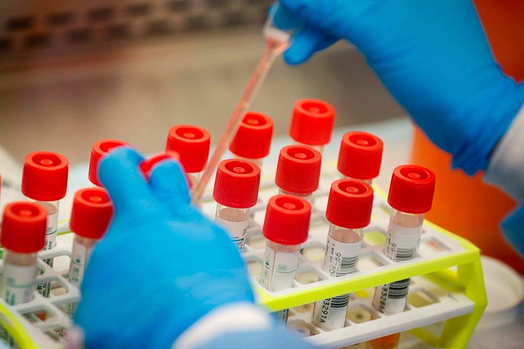 An Edmonton-based company says its test can determine with certainty whether someone has contracted COVID-19. It said its system can also complete up to 20,000 tests every day.