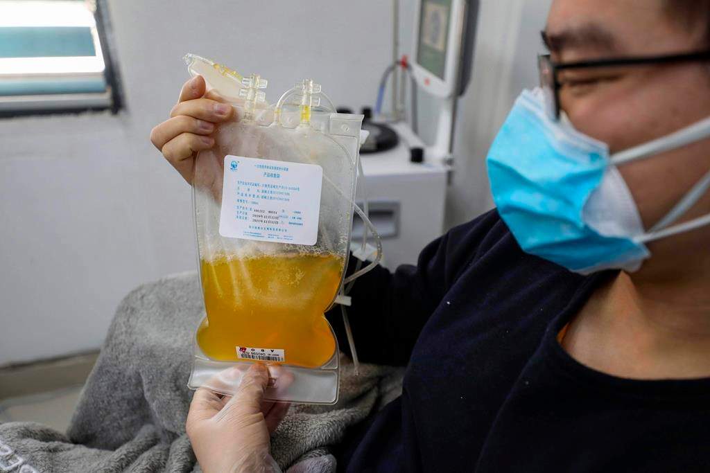 FILE - In this Feb. 18, 2020, file photo, Dr. Zhou Min, a recovered COVID-19 patient who has passed his 14-day quarantine, donates plasma in the city's blood center in Wuhan in central China's Hubei province.