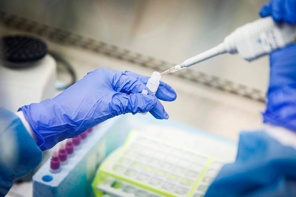London-Middlesex sees 13 new coronavirus cases on Good Friday, total now 183 - image
