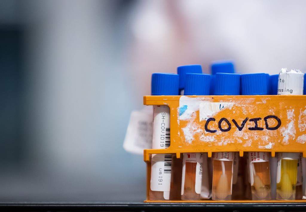 Residents at a long-term care home in London, Ont., have tested positive for COVID-19.