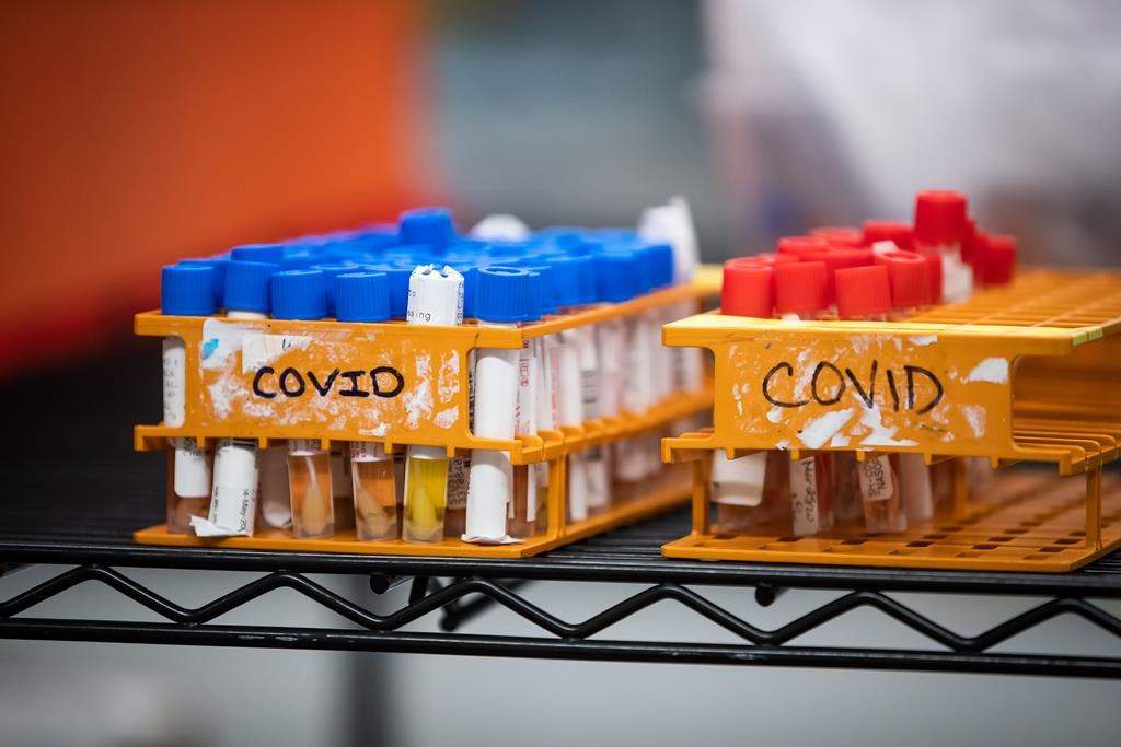 Specimens to be tested for COVID-19 are seen at LifeLabs.
