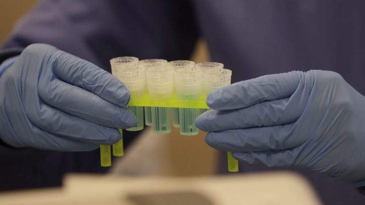 In this April 3, 2020, photo, a technician holds blue preservation solution in a clean room where saliva collection devices are assembled at Spectrum DNA in Draper, Utah. The company has developed a test kit to detect the coronavirus in patients' saliva.