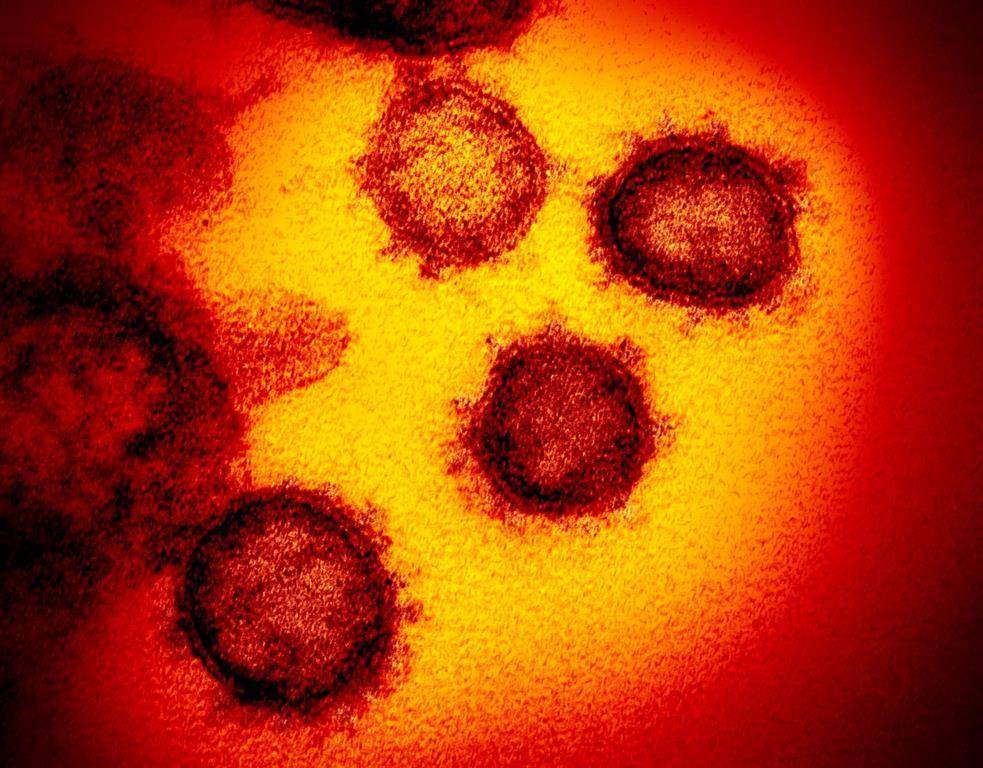  This undated electron microscope image made available by the U.S. National Institutes of Health in February 2020 shows the Novel Coronavirus SARS-CoV-2. Also known as 2019-nCoV, the virus causes COVID-19.