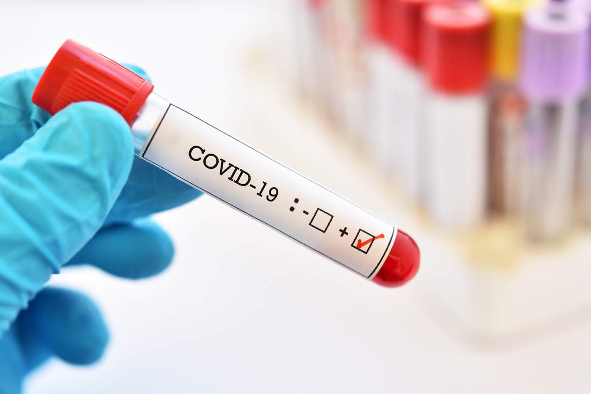 Blood sample tube positive with COVID-19 or novel coronavirus 2019 found in Wuhan, China.