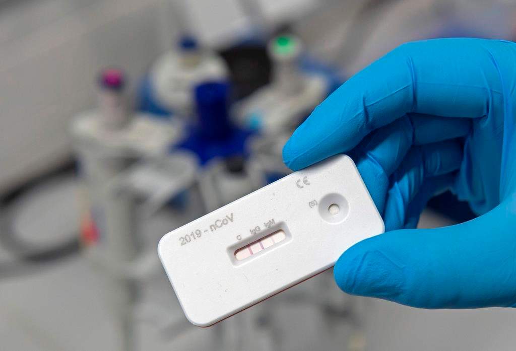 A scientist presents an antibody test for coronavirus in a laboratory of the Leibniz Institute of Photonic Technology (Leibniz IPHT) at the InfectoGnostics research campus in Jena, Germany, Friday, April 3, 2020.