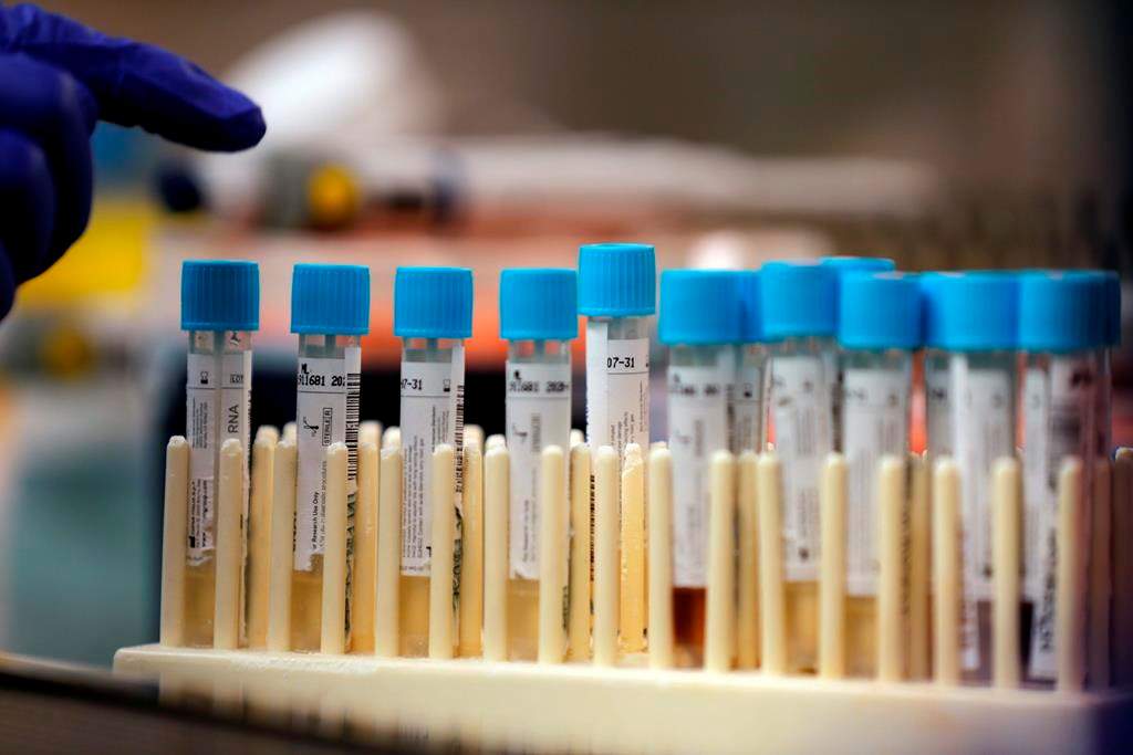 Peterborough Public Health reports 22 tests for coronavirus have been rejected by a lab in Ottawa due to a technical error.