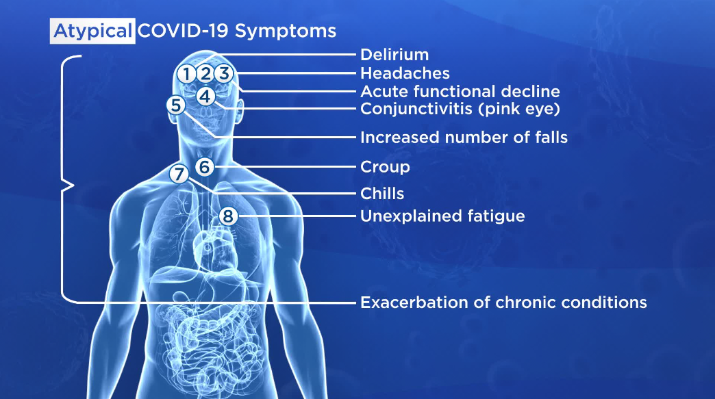 Atypical COVID-19 symptoms