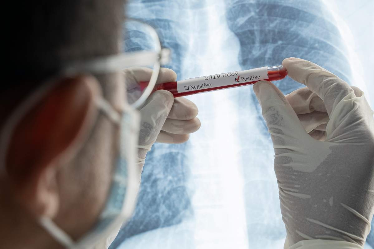 Ottawa Public Health says 252 people in the city have died as a result of complications from the novel coronavirus.