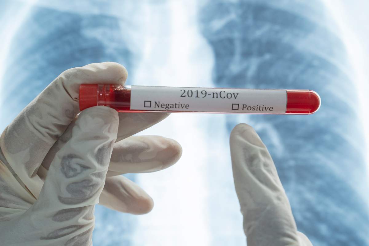 The Saskatchewan Health Authority says a person who was working at Sunnyside Bar this past weekend has tested positive for the novel coronavirus.