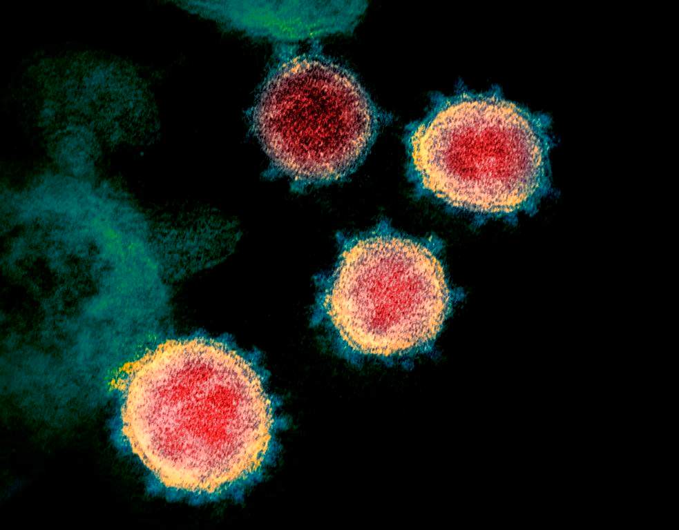 This undated electron microscope image made available by the U.S. National Institutes of Health in February 2020 shows the virus that causes COVID-19. THE CANADIAN PRESS/NIAID-RML via AP