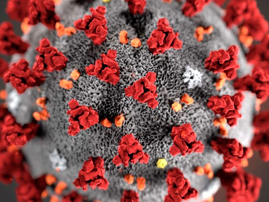 In this illustration provided by the Centers for Disease Control and Prevention (CDC) in January 2020 shows the 2019 Novel Coronavirus (2019-nCoV). This virus was identified as the cause of an outbreak of respiratory illness first detected in Wuhan, China. Consumer insolvencies are expected to spike in the wake of the COVID-19 pandemic despite a reprieve in the number of filings in March. THE CANADIAN PRESS/CDC via AP, File.