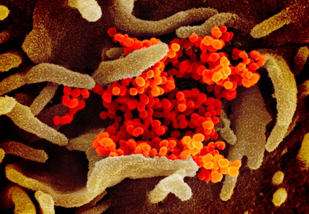 This undated electron microscope image made available by the U.S. National Institutes of Health in February 2020 shows the Novel Coronavirus SARS-CoV-2, orange, emerging from the surface of cells, green, cultured in the lab.