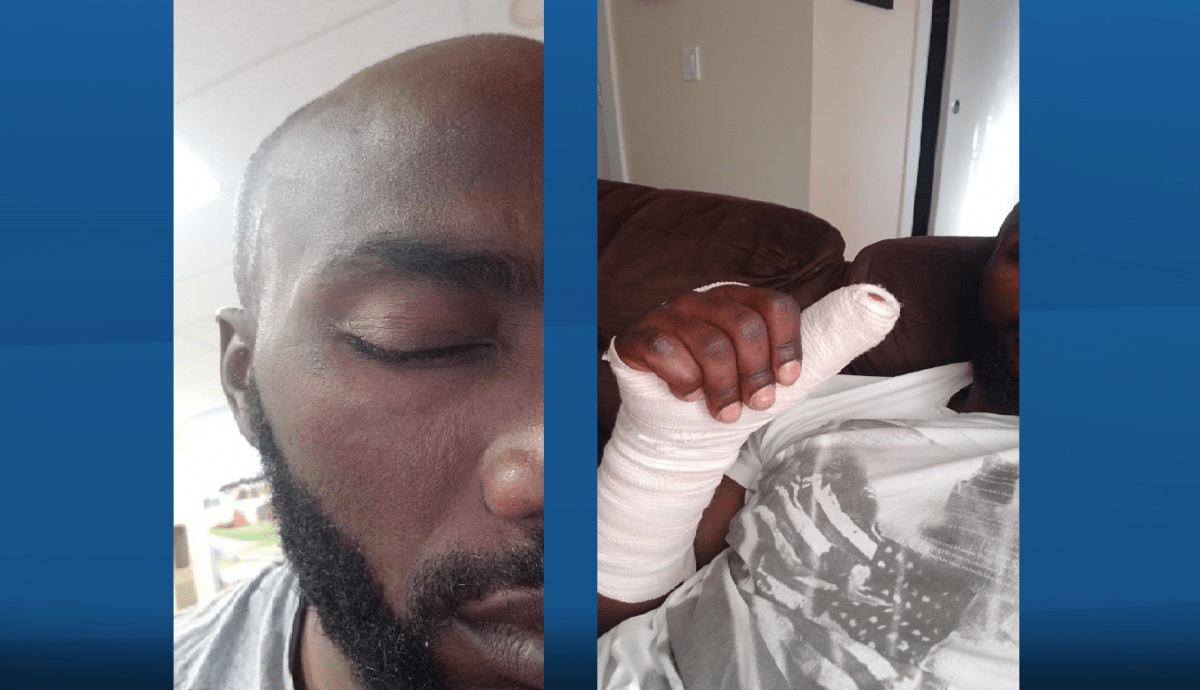 Sifa Ngeze shared photos of her husband Jean-Claude Rukundo after his July 27, 2018 arrest in Edmonton.
