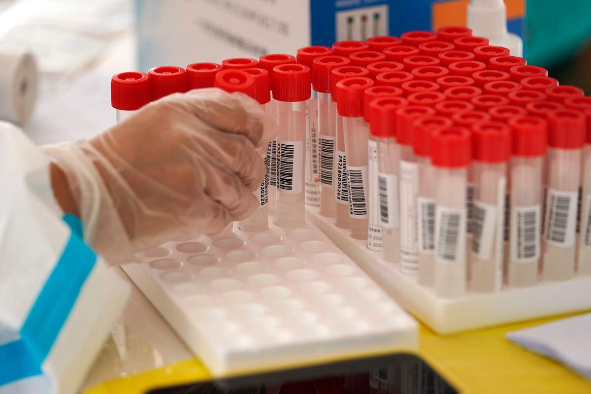 In addition to a new fatality, Saskatchewan health authorities say there is one new coronavirus case in the province and 54 active cases.