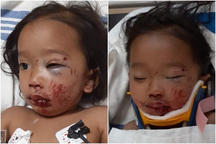 Calgary police say three-year-old Kaylie was severely injured in a hit-and-run collision in the 0-100 block of Deerfield Villas Southeast on Monday, June 22, 2020.