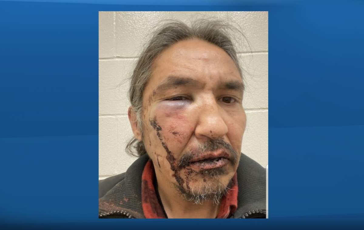 Chief Allan Adam of the Athabascan Chipewyan First Nation.