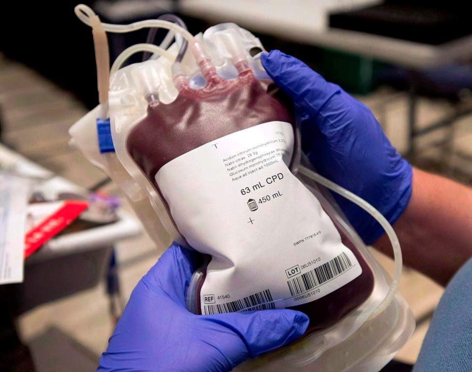 New research suggests that there may be a link between blood type and coronavirus risk.