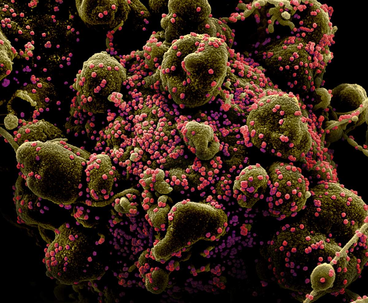 Colorized scanning electron micrograph of an apoptotic cell (greenish brown) heavily infected with SARS-COV-2 virus particles (pink), isolated from a patient sample. Image captured and color-enhanced at the NIAID Integrated Research Facility (IRF) in Fort Detrick, Maryland. 