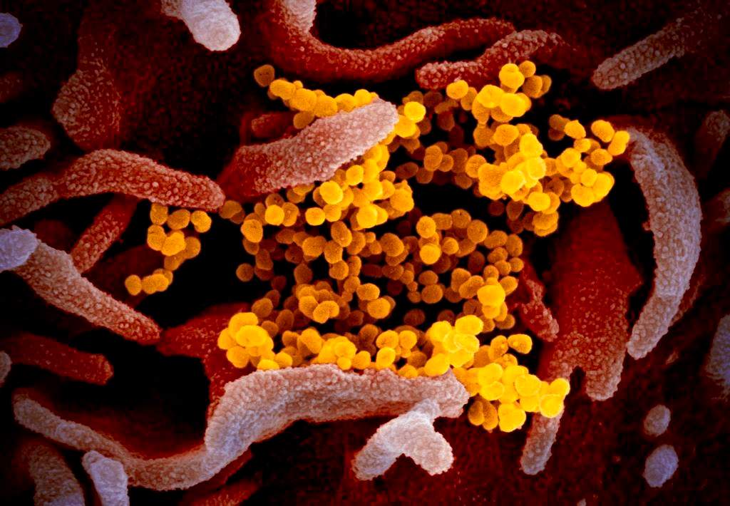This undated electron microscope image made available by the U.S. National Institutes of Health in February 2020 shows the Novel Coronavirus SARS-CoV-2, yellow, emerging from the surface of cells, pink, cultured in the lab. Also known as 2019-nCoV, the virus causes COVID-19. The sample was isolated from a patient in the U.S. On Thursday, March 5, 2020, Tennessee's Department of Health Commissioner Lisa Piercey confirmed the state's first case of the new coronavirus. (NIAID-RML via AP).