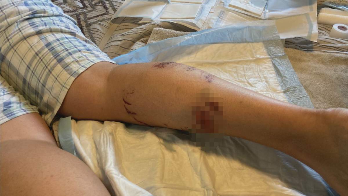 Driver was left with scrapes and significant puncture wounds on her calf.