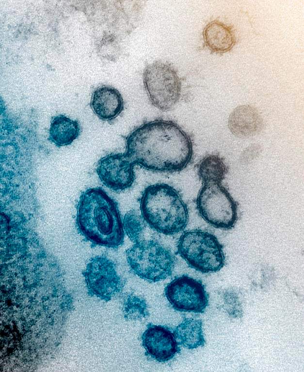 A new research study from Western University and Lawson Health has linked stroke as a side effect of the novel coronavirus.