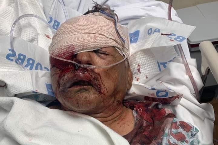 Roberto Flores Lopez, 80, is shown after he was attacked at a grocery store in Lancaster, Calif., on July 8, 2020.