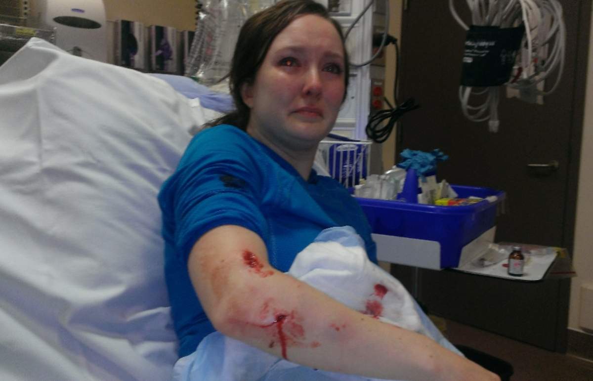 Stephanie Browne’s injuries in 2014.