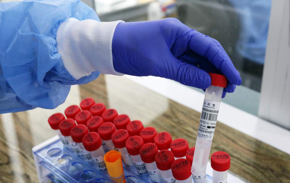 Saskatchewan has one of the highest rates of active coronavirus cases per capita in Canada.