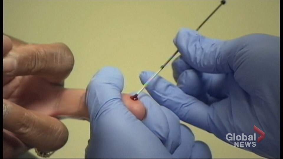 World AIDS Day: Calls continue for better HIV prevention in N.S. - image
