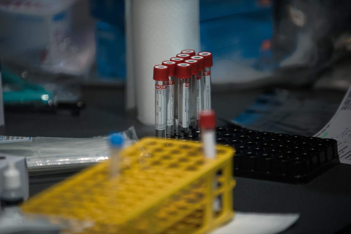 Vial which will contain swab to test for the Covid-19 is seen during a mass Covid-19 testing operation in Roubaix, France, on January 13, 2021. 