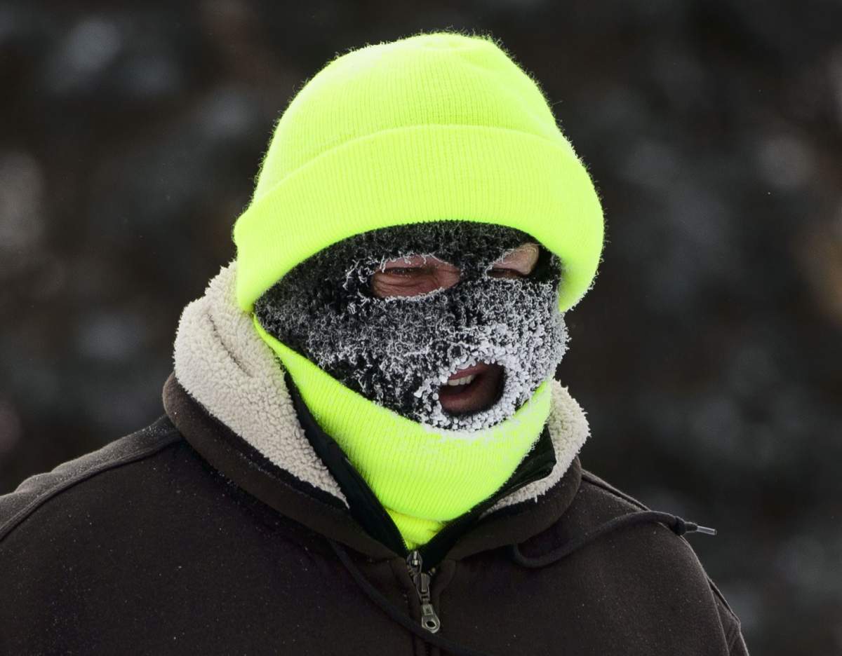 Peterborough Public Health has issued a frostbite alert for the region.