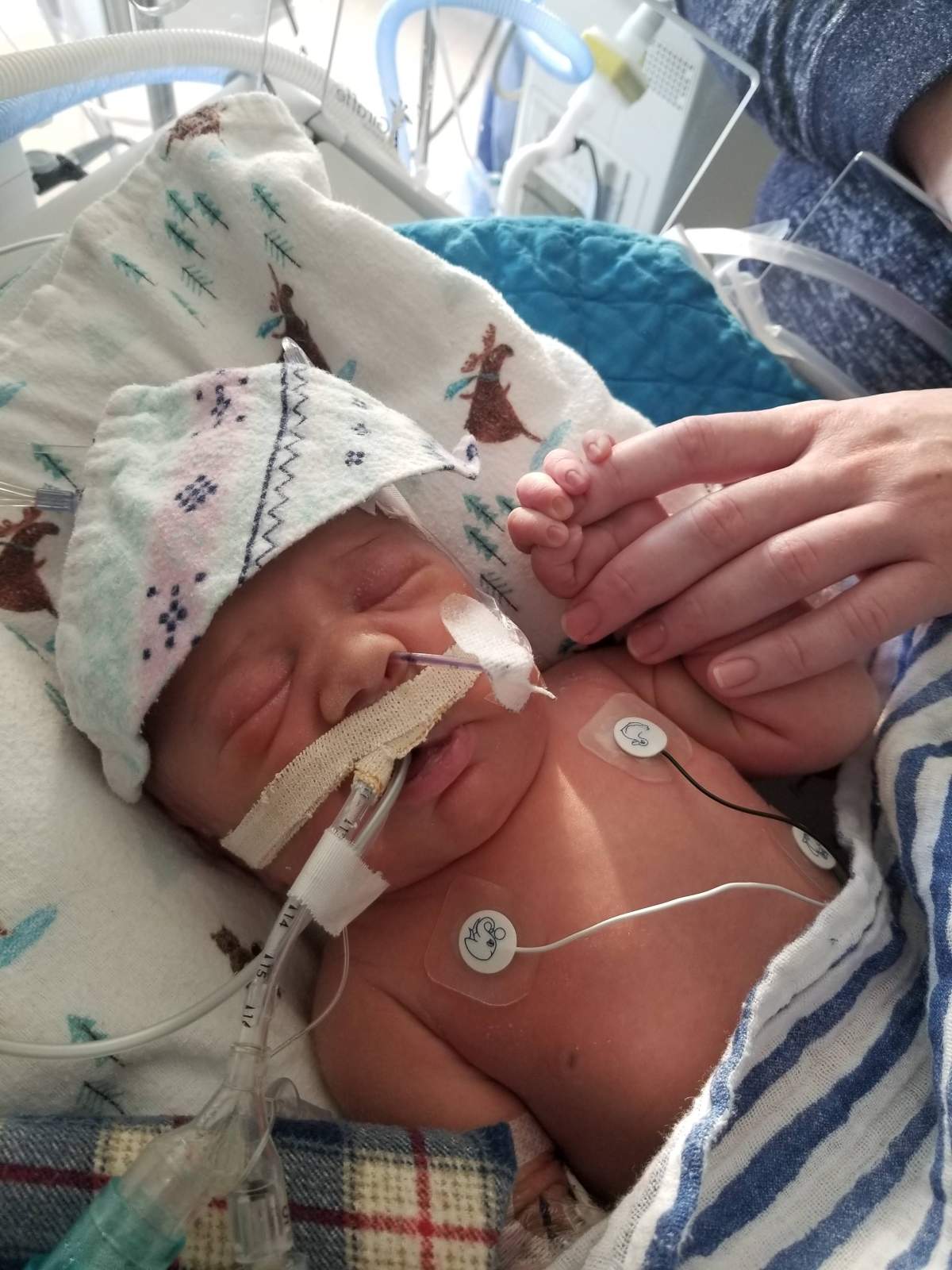Baby Roman “charming” mom pre open-heart surgery (Justina Spencer/Provided)