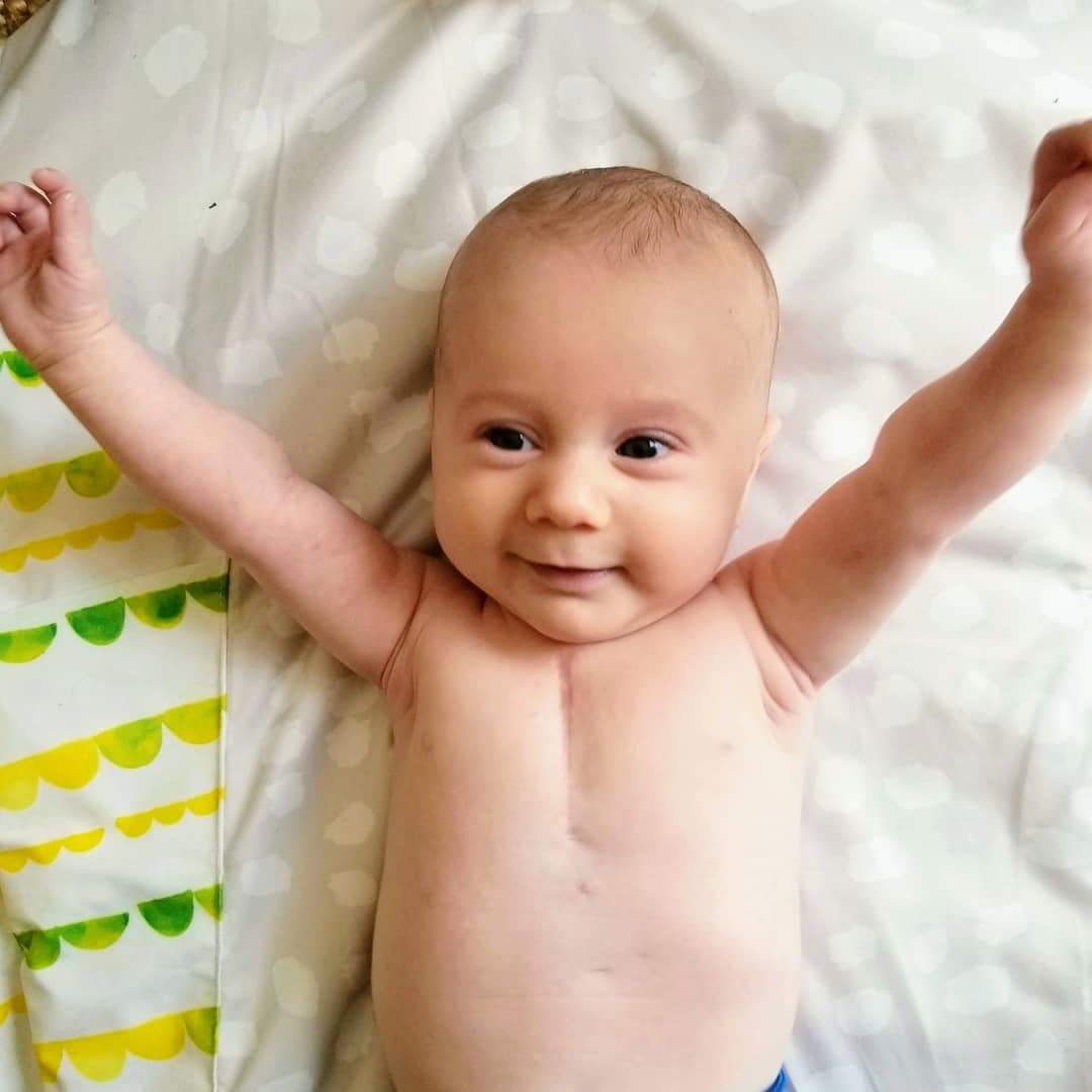 Roman, happy and healthy at home following open-heart surgery to correct a congenital heart defect (Justina Spencer/Provided)