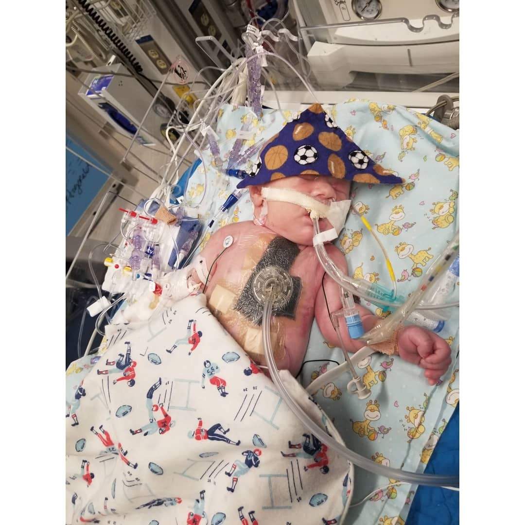 Roman following 11 hours of open-heart surgery to correct a congenital heart defect (Justina Spencer/Provided)