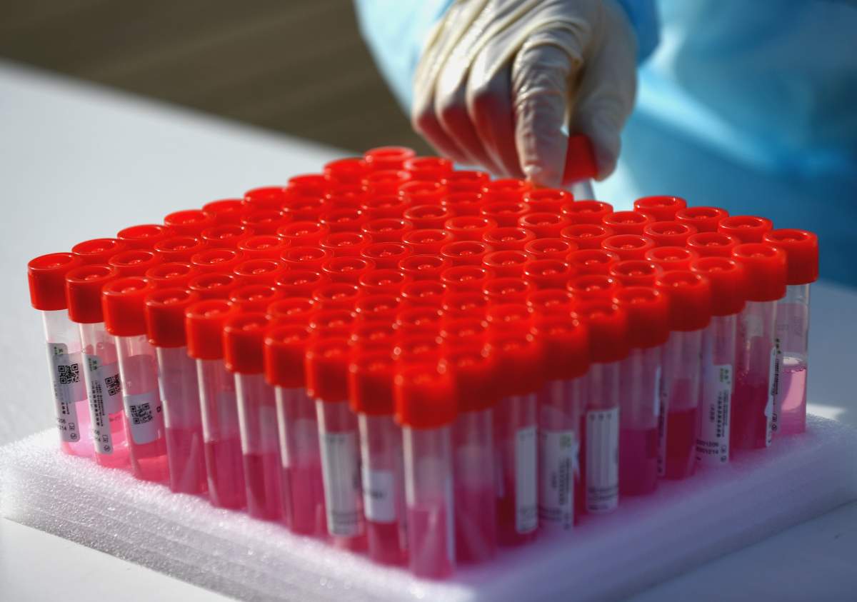 Manitoba reported 218 new COVID-19 cases and no additional deaths from the virus Tuesday.