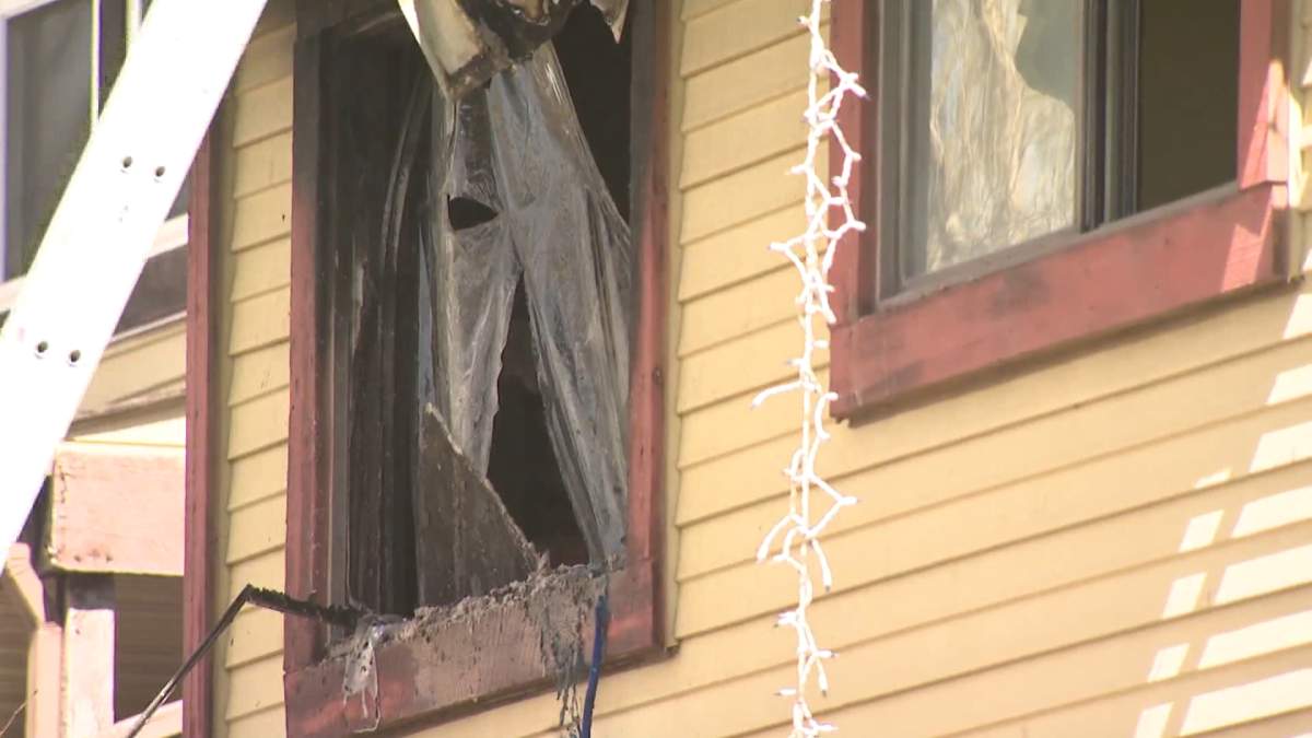 A man was hospitalized after a house fire in northwest Calgary.
