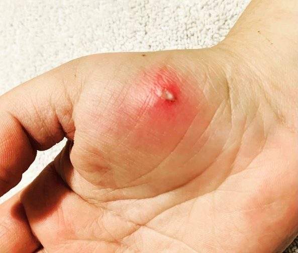 Tatyonia Maude was refused a tetanus shot for her cat bite until she got a COVID-19 vaccine.