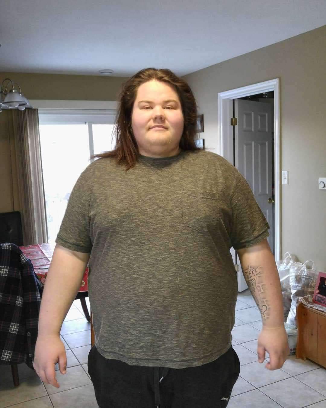 Connor Terry before losing 225 lbs.