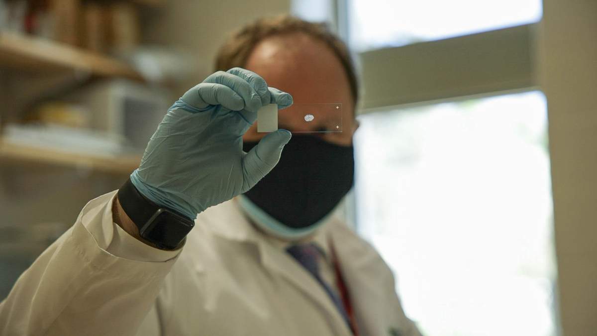 Jake Pushie, a research scientist at the University of Saskatchewan, holds up a tissue sample.