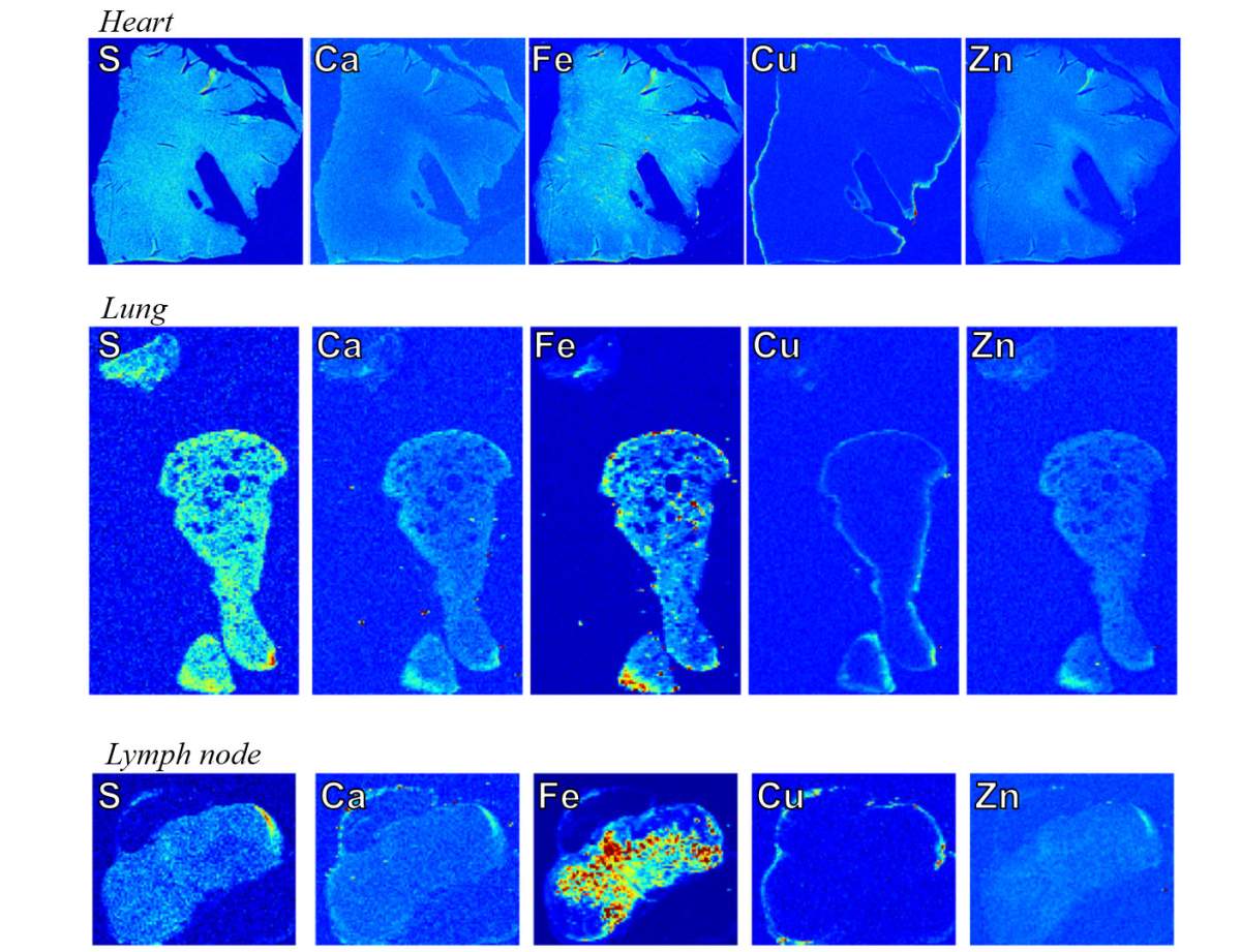 Elemental imaging of tissue samples produced by the synchrotron at Canadian Light Source.