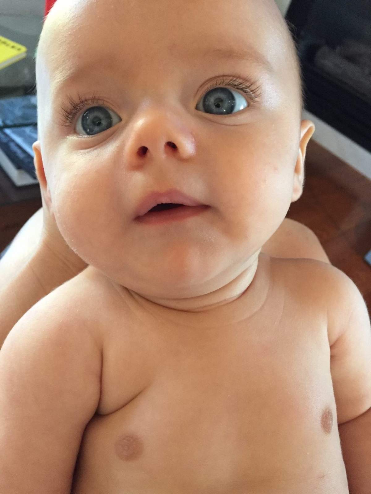 Lewiston was diagnosed with spinal muscular atrophy Type 1 when he was 2.5 months old.