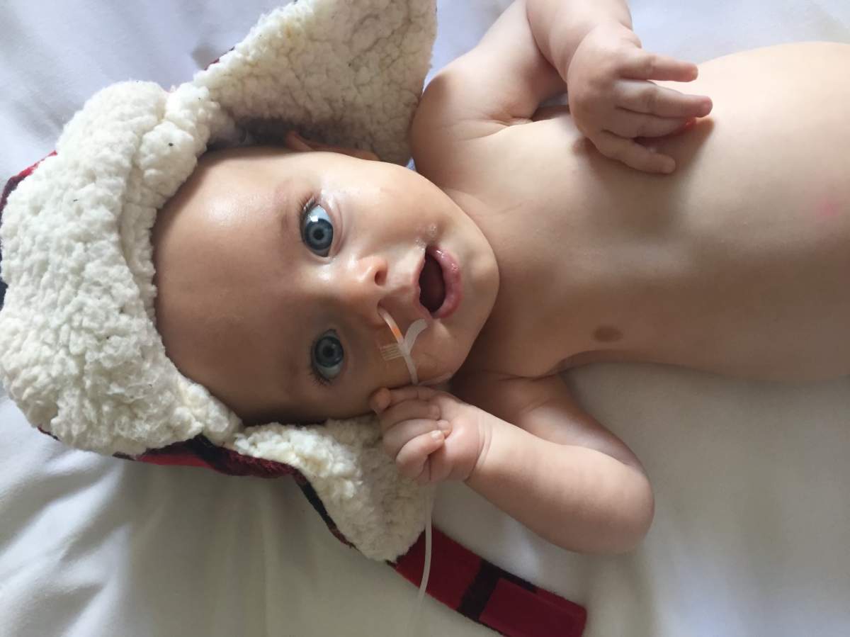 Lewiston was diagnosed with spinal muscular atrophy Type 1 when he was 2.5 months old.