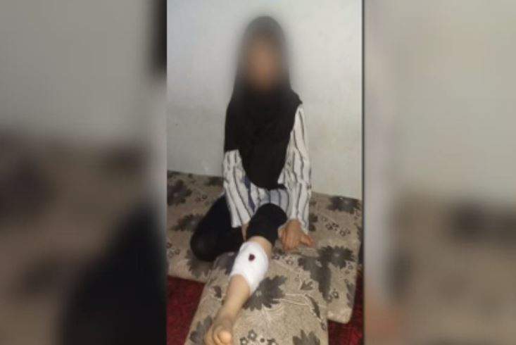 Shiba Mohammadi’s sister who was struck by a bullet in the leg in July of 2021 during fighting between the Taliban and Afghan military.