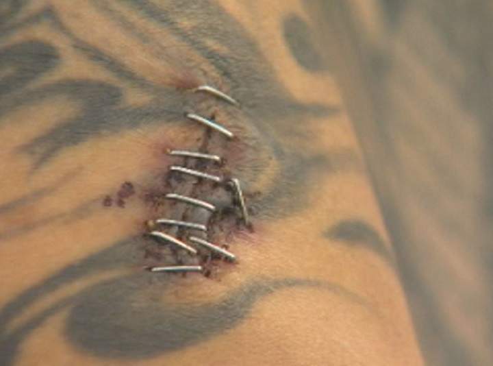 A still image of a stab wound Maxie suffered on his arm from the attack.