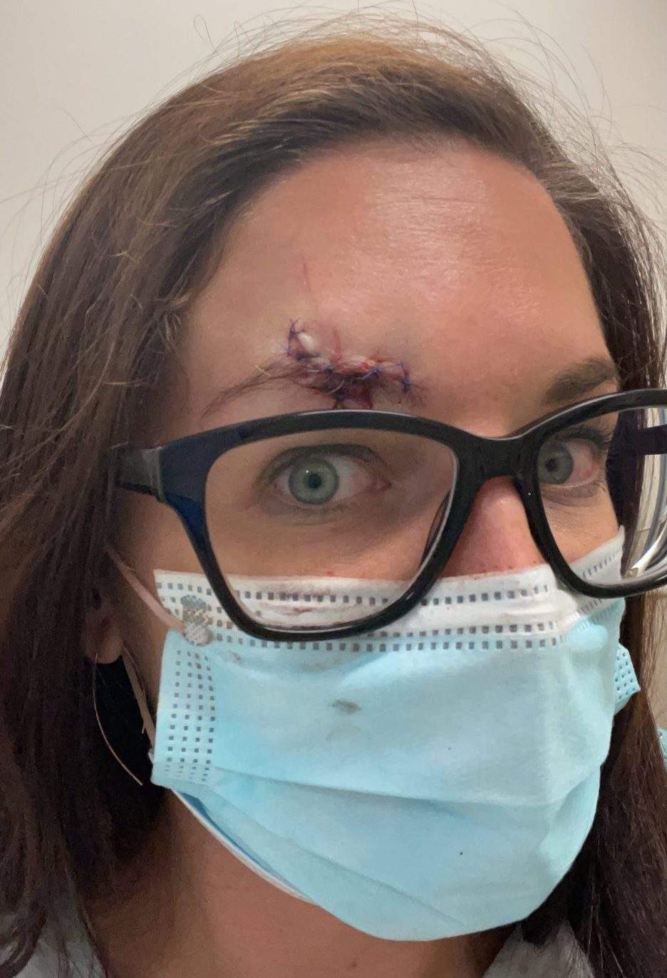 Alyson Shane spent 10 hours in a waiting room with a head injury.