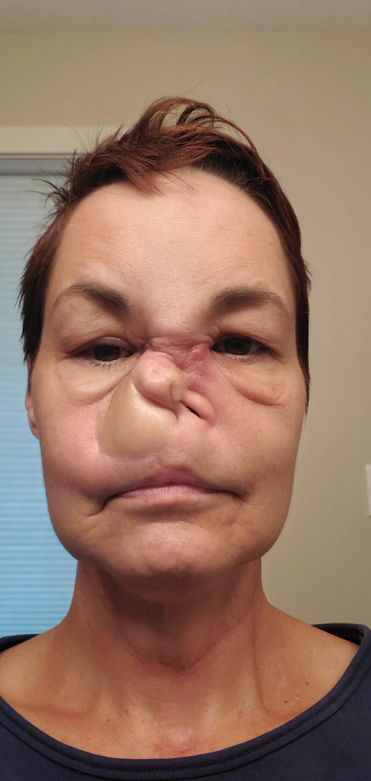 Sharon Durham is seen in an undated handout photo. Durham says she is worried she will lose her eye sight or possibly die after a surgery scheduled in Edmonton for the rare cancer in her face was cancelled because she's not a resident of the province. 